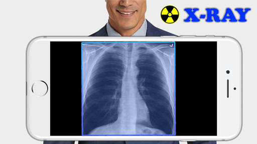 X-Ray Filter Photo  Featured Image